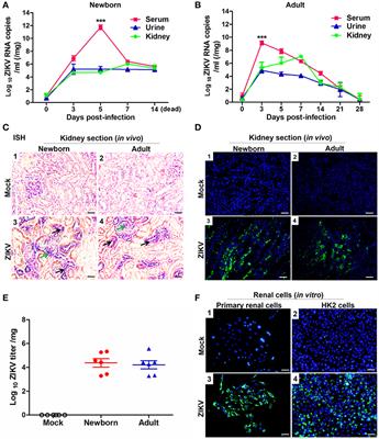 Zika Virus Infection Induces Acute Kidney Injury Through Activating NLRP3 Inflammasome Via Suppressing Bcl-2